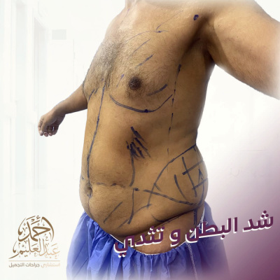 Dr Ahmed AbdelAlem Plastic Surgery Clinic - Dr Ahmed AbdelAlem Plastic Surgery Clinic