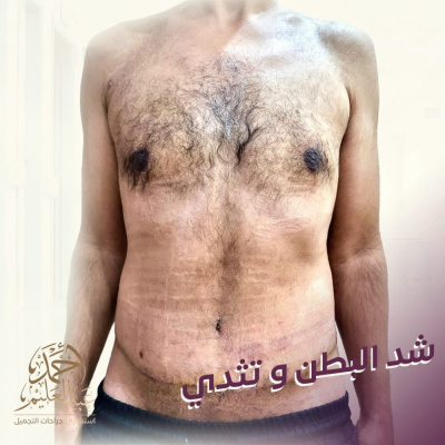 Dr Ahmed AbdelAlem Plastic Surgery Clinic - Dr Ahmed AbdelAlem Plastic Surgery Clinic