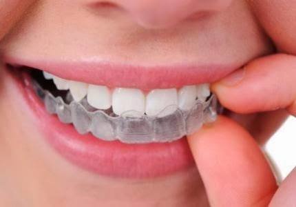 مركز الدكتور أحمد بدر لطب الأسنان - Dr ahmed badr dental center