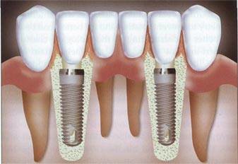 مركز الدكتور أحمد بدر لطب الأسنان - Dr ahmed badr dental center