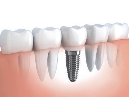 مركز الدكتور أحمد بدر لطب الأسنان - Dr ahmed badr dental center