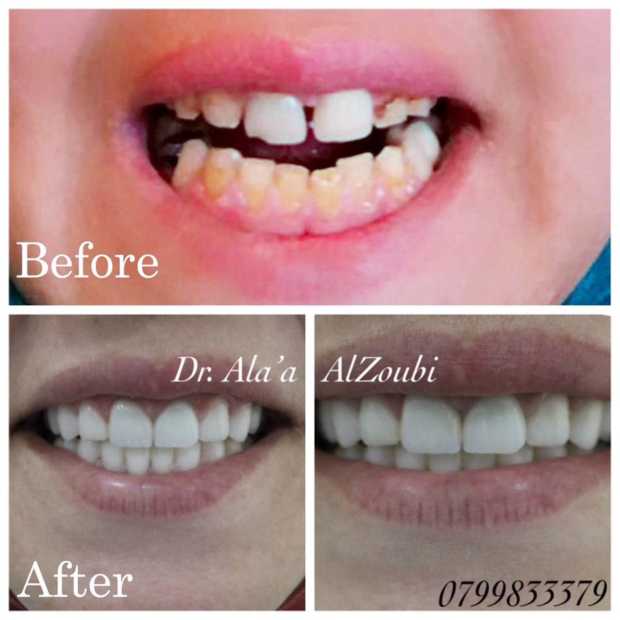 Dr Alaa Dental Clinic - Dr Alaa Dental Clinic
