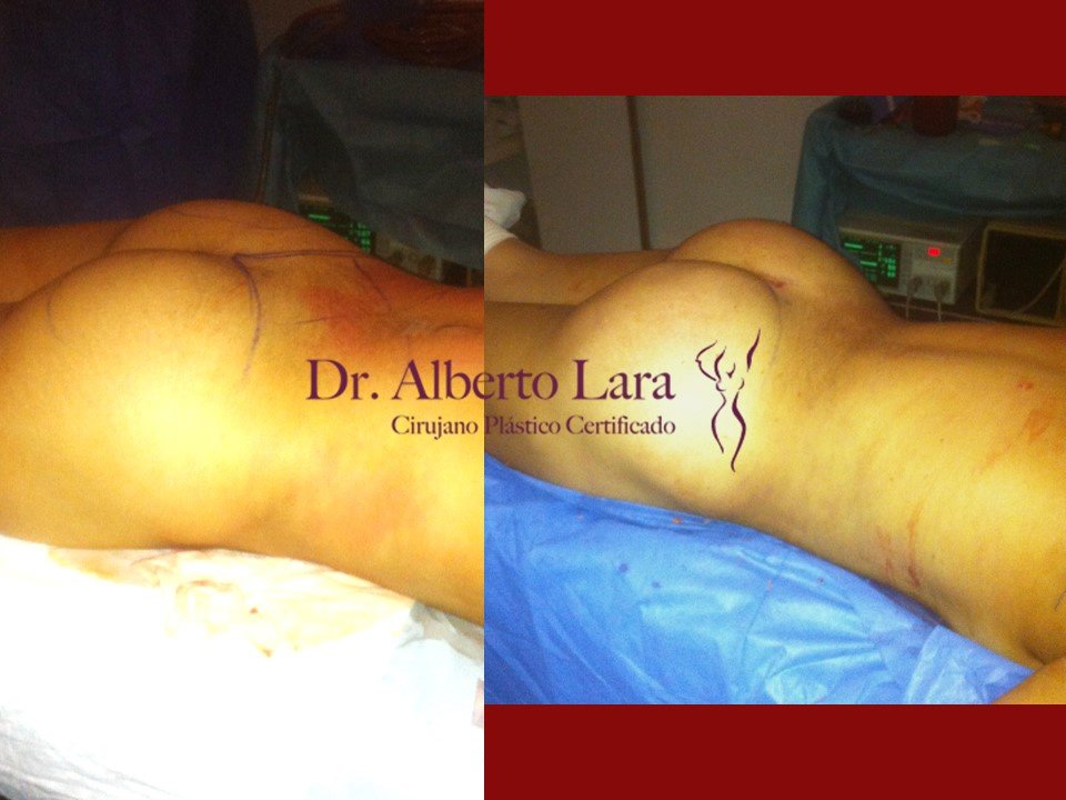 Dr Alberto Lara - Dr Alberto Lara