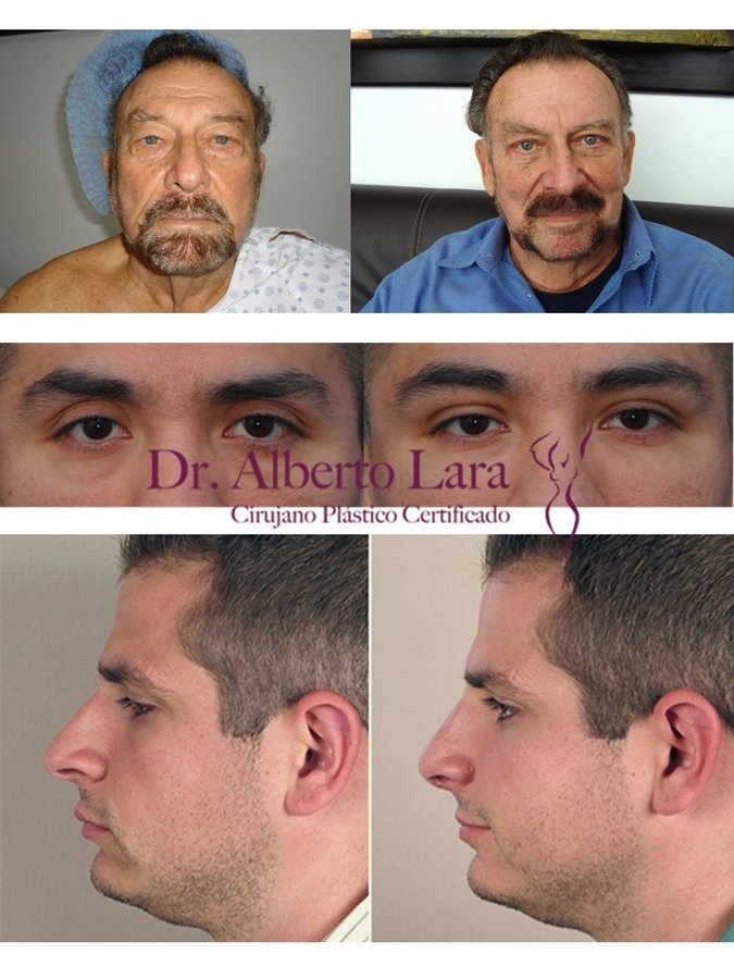 Dr Alberto Lara - Dr Alberto Lara