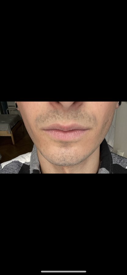 Dr Alberto Leguina-Ruzzi MD PhD - Dr Alberto Leguina-Ruzzi MD PhD