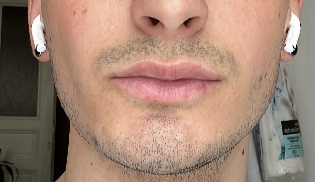 Dr Alberto Leguina-Ruzzi MD PhD - Dr Alberto Leguina-Ruzzi MD PhD