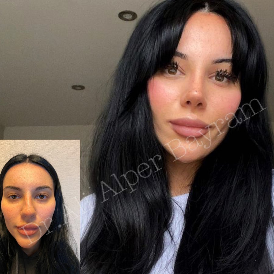 Dr Ali Alper Bayram - Dr Ali Alper Bayram