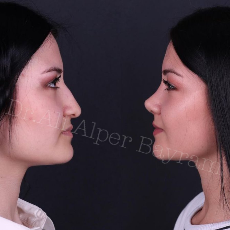 Dr Ali Alper Bayram - Dr Ali Alper Bayram