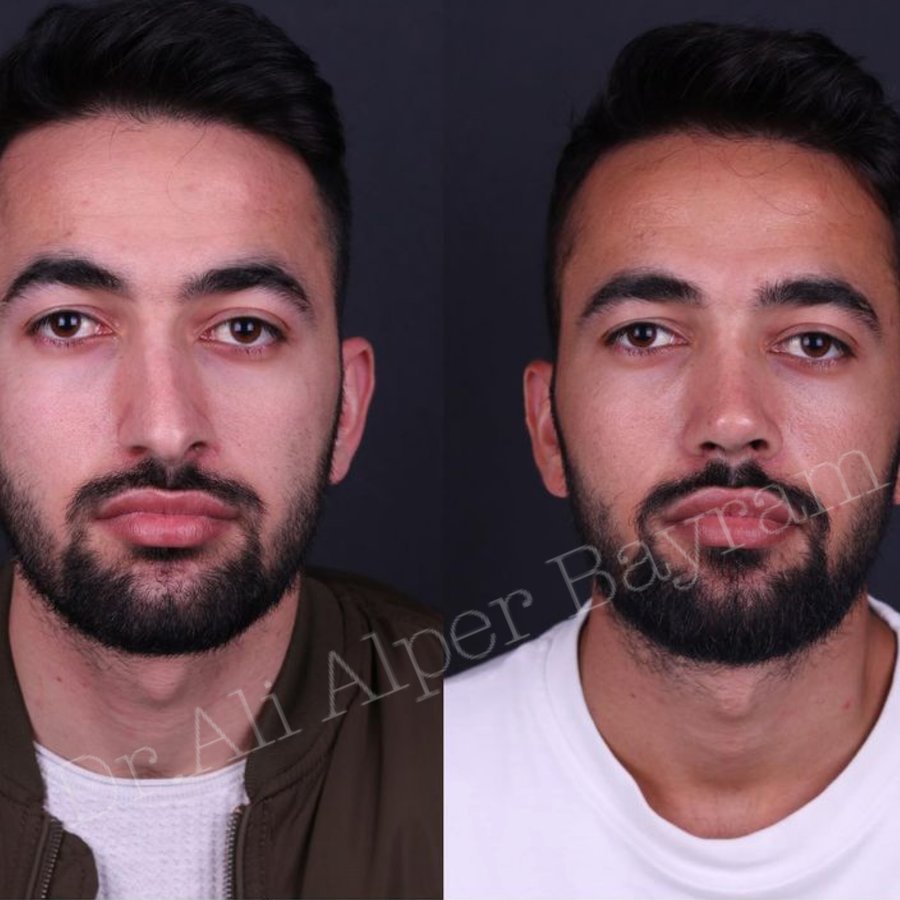 Dr Ali Alper Bayram - Dr Ali Alper Bayram