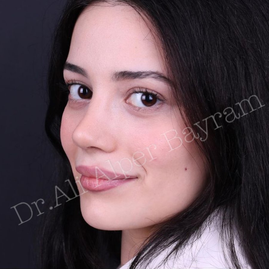 Dr Ali Alper Bayram - Dr Ali Alper Bayram