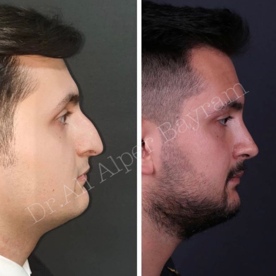 Dr Ali Alper Bayram - Dr Ali Alper Bayram