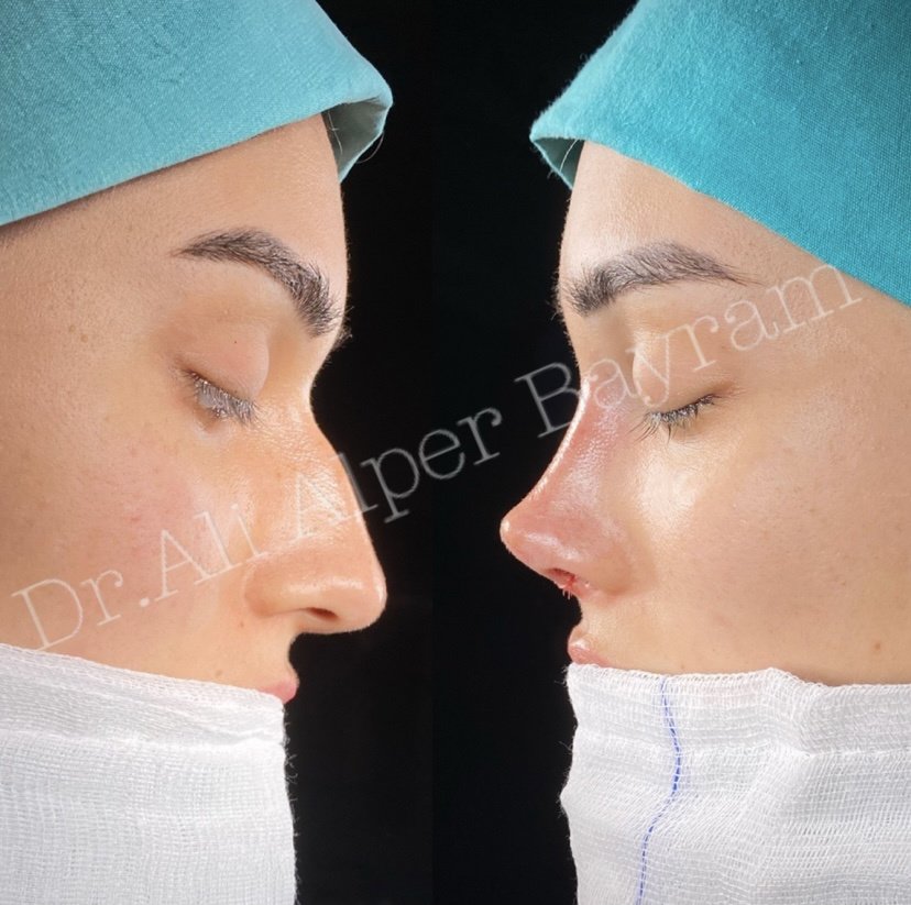 Dr Ali Alper Bayram - Dr Ali Alper Bayram