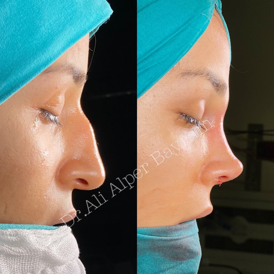 Dr Ali Alper Bayram - Dr Ali Alper Bayram