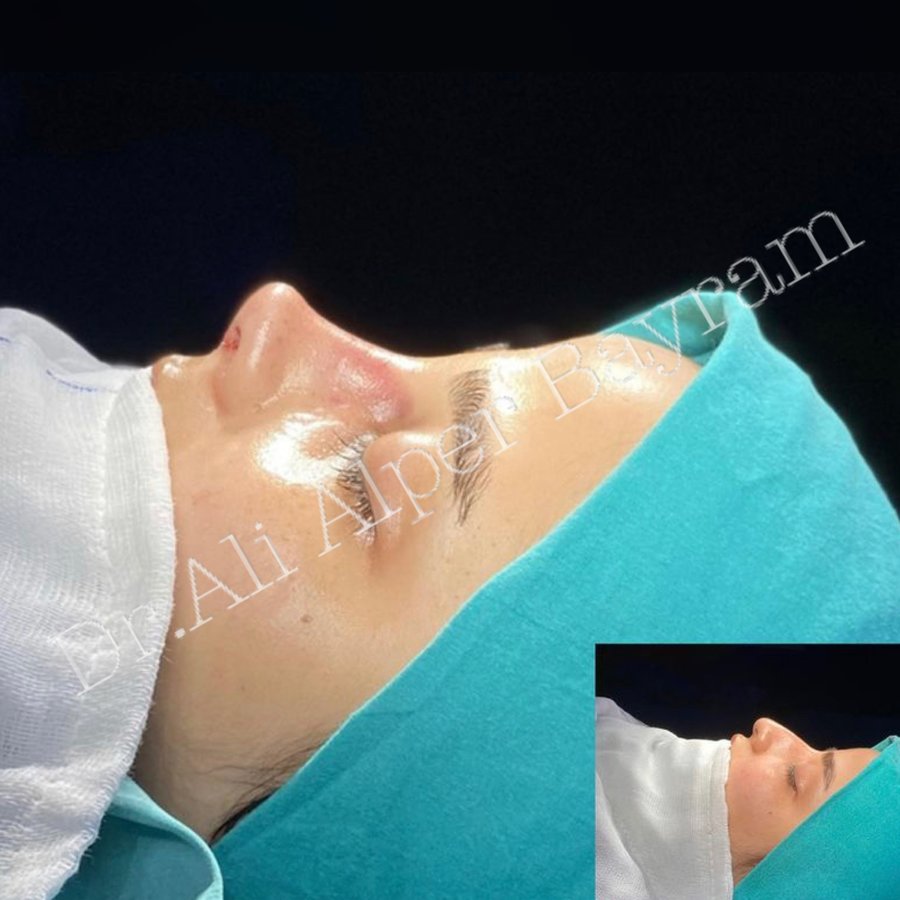 Dr Ali Alper Bayram - Dr Ali Alper Bayram