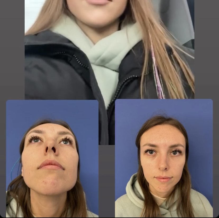 Dr Ali Alper Bayram - Dr Ali Alper Bayram