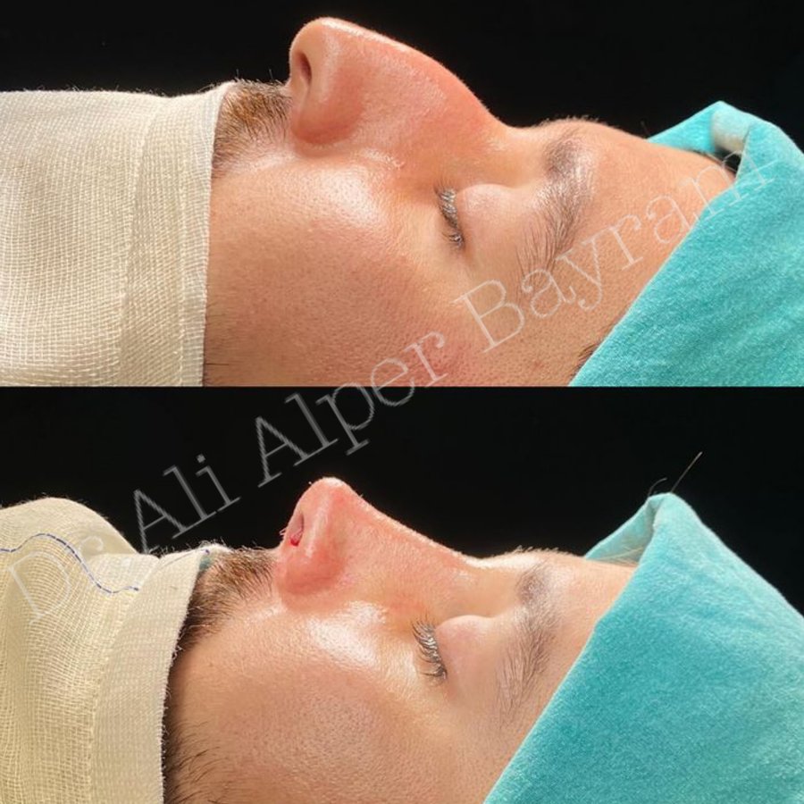 Dr Ali Alper Bayram - Dr Ali Alper Bayram