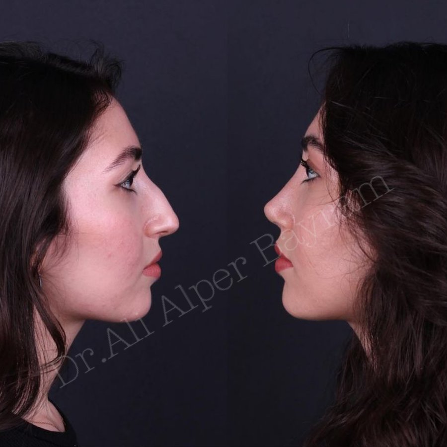 Dr Ali Alper Bayram - Dr Ali Alper Bayram