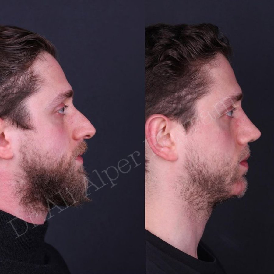 Dr Ali Alper Bayram - Dr Ali Alper Bayram