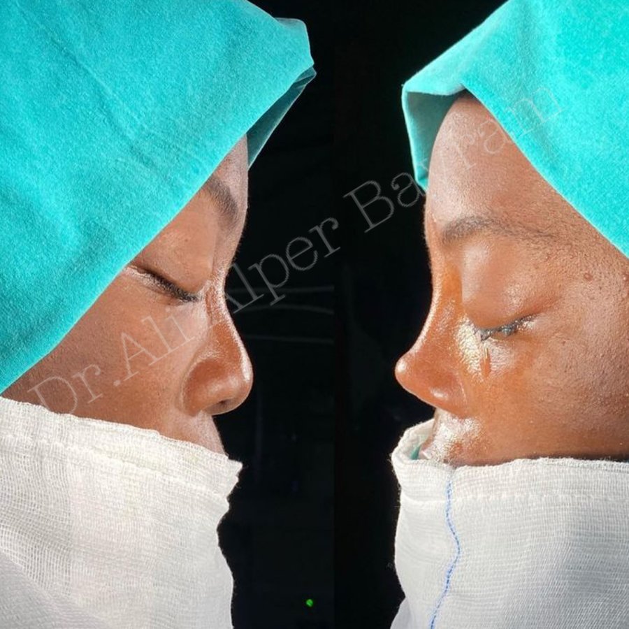 Dr Ali Alper Bayram - Dr Ali Alper Bayram