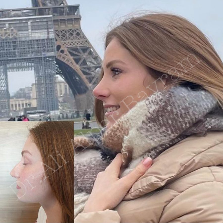 Dr Ali Alper Bayram - Dr Ali Alper Bayram