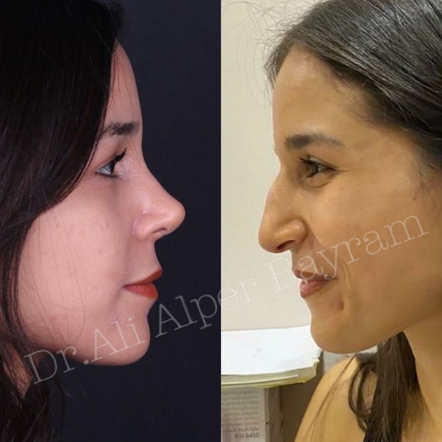 Dr Ali Alper Bayram - Dr Ali Alper Bayram