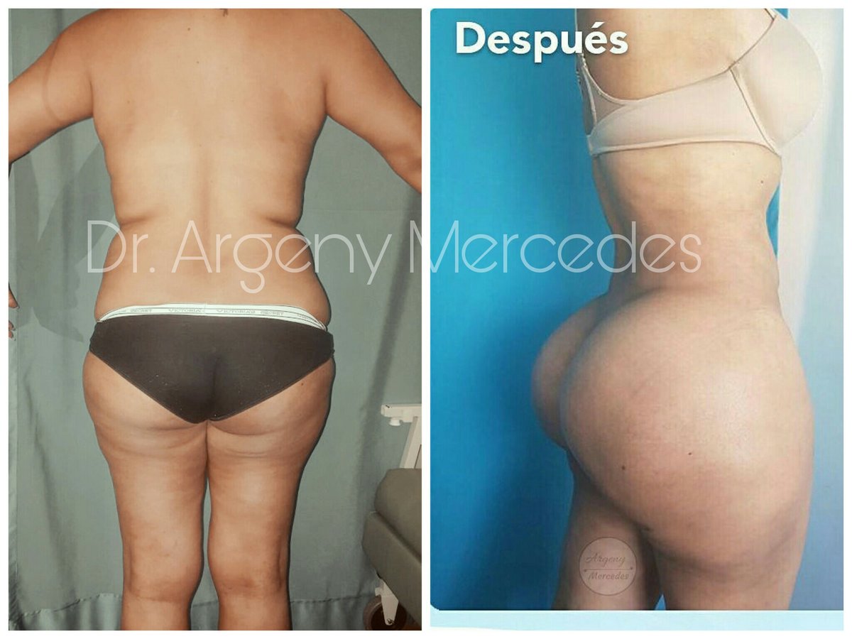 Dr. Argeny Mercedes - Dr. Argeny Mercedes