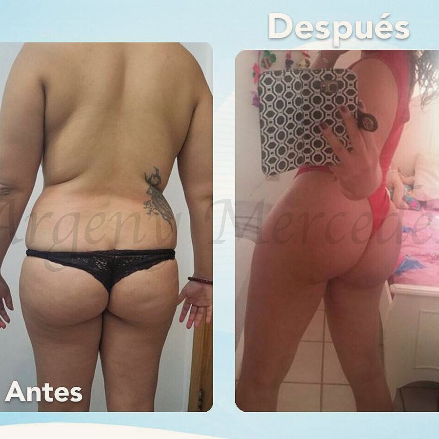 Dr. Argeny Mercedes - Dr. Argeny Mercedes