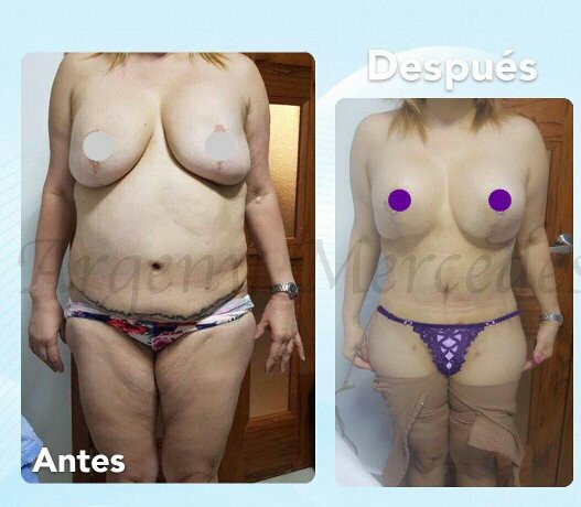 Dr. Argeny Mercedes - Dr. Argeny Mercedes