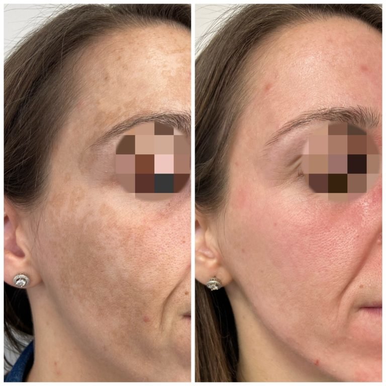 Dr Ayad Aesthetics Clinic in Bicester - Dr Ayad Aesthetics Clinic in Bicester