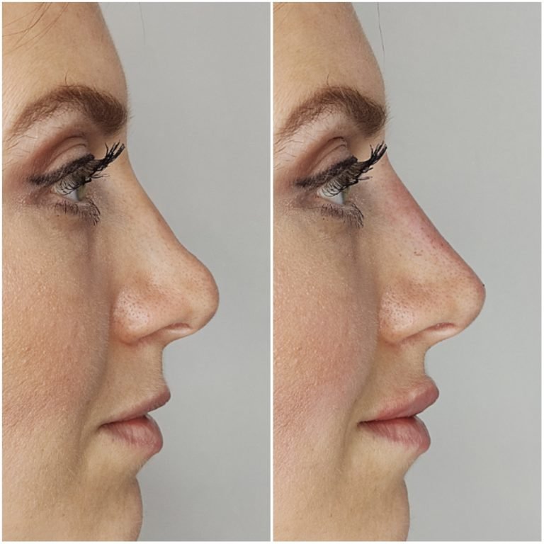 Dr Ayad Aesthetics Clinic in Bicester - Dr Ayad Aesthetics Clinic in Bicester