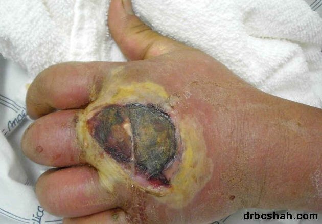 Dr. B. C. Shah Laparoscopic and General Surgeon - Dr. B. C. Shah Laparoscopic and General Surgeon