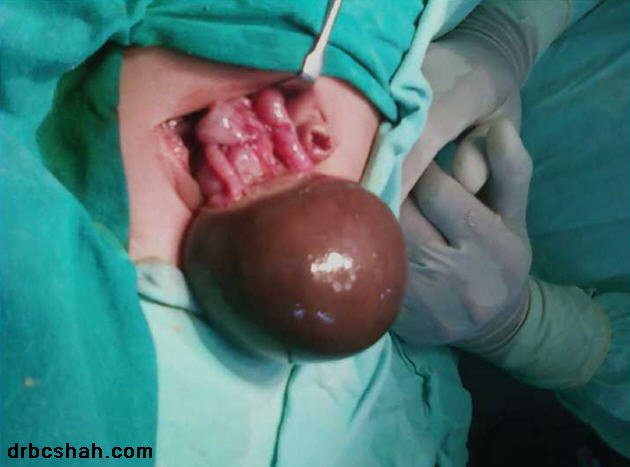 Dr. B. C. Shah Laparoscopic and General Surgeon - Dr. B. C. Shah Laparoscopic and General Surgeon