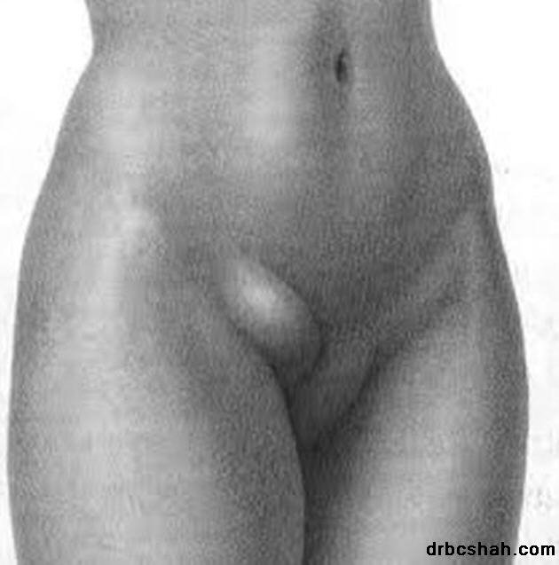 Dr. B. C. Shah Laparoscopic and General Surgeon - Dr. B. C. Shah Laparoscopic and General Surgeon