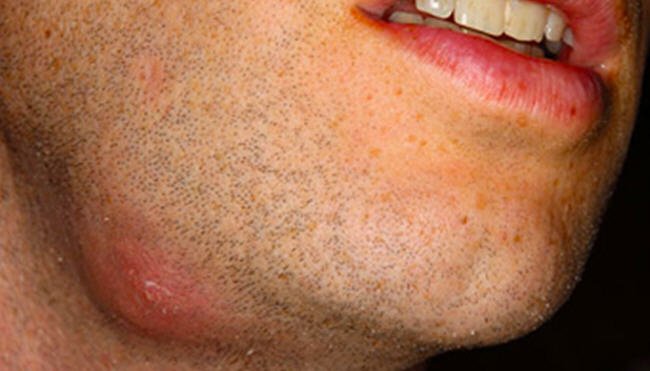 Dr. B. C. Shah Laparoscopic and General Surgeon - Dr. B. C. Shah Laparoscopic and General Surgeon