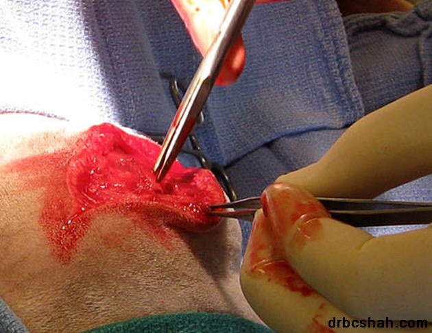 Dr. B. C. Shah Laparoscopic and General Surgeon - Dr. B. C. Shah Laparoscopic and General Surgeon