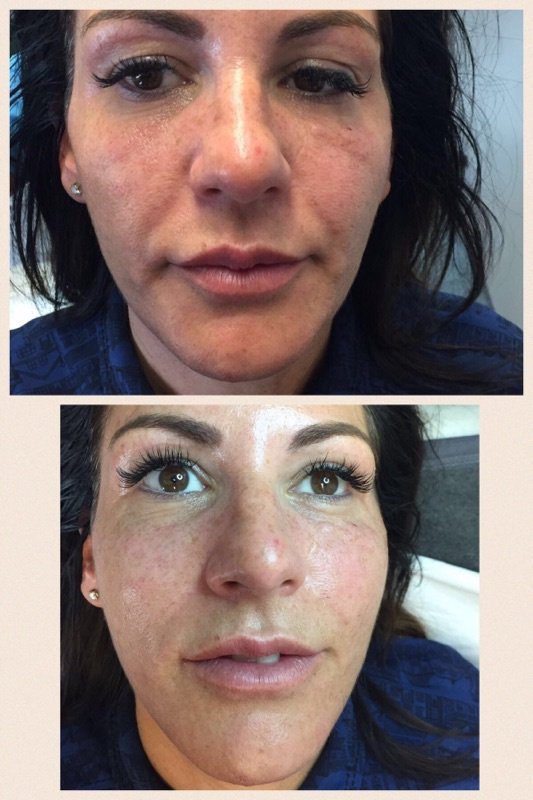 Dr Ban Ratti Medical Aesthetics Windsor - Dr Ban Ratti Medical Aesthetics Windsor