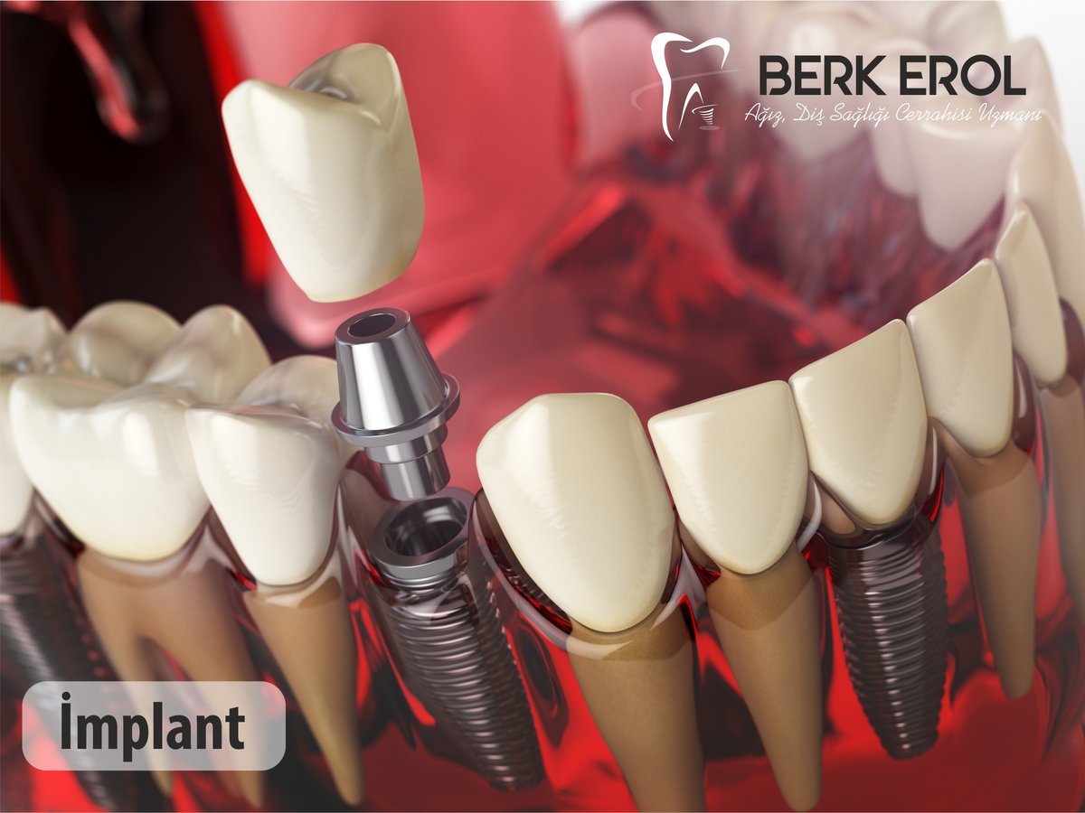 Dr. Berk EROL DDS PhD Oral Surgeon&Implantologist - Dr. Berk EROL DDS PhD Oral Surgeon&Implantologist