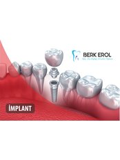Dr. Berk EROL DDS PhD Oral Surgeon&Implantologist - Dr. Berk EROL DDS PhD Oral Surgeon&Implantologist