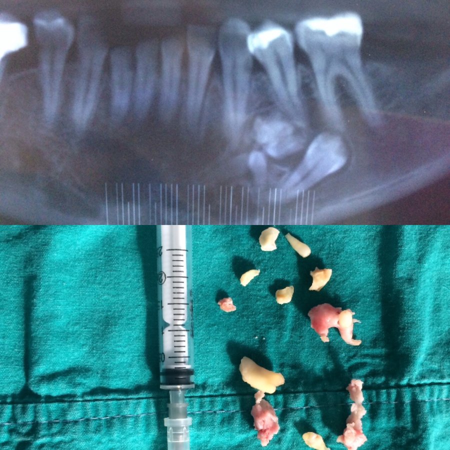 Dr. Bertan Buyan - Dr. Muzaffer Buyan - Dr. Bertan Buyan - Dr. Muzaffer Buyan