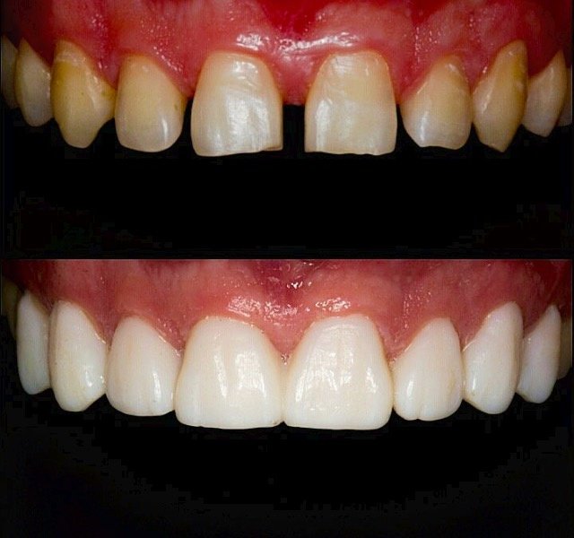 Dr. Bertan Buyan - Dr. Muzaffer Buyan - Dr. Bertan Buyan - Dr. Muzaffer Buyan
