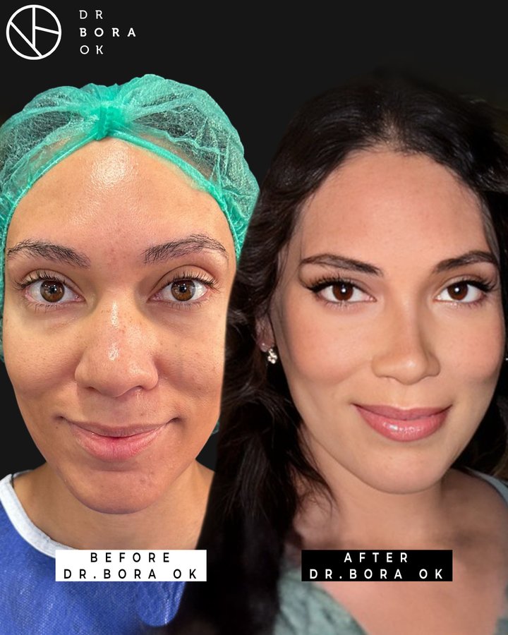 Dr. Bora Ok - Aesthetic Plastic Surgery Clinic - Dr. Bora Ok - Aesthetic Plastic Surgery Clinic
