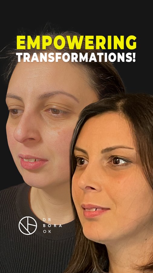 Dr. Bora Ok - Aesthetic Plastic Surgery Clinic - Dr. Bora Ok - Aesthetic Plastic Surgery Clinic