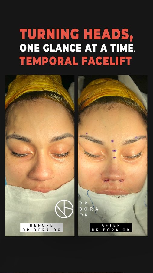 Dr. Bora Ok - Aesthetic Plastic Surgery Clinic - Dr. Bora Ok - Aesthetic Plastic Surgery Clinic