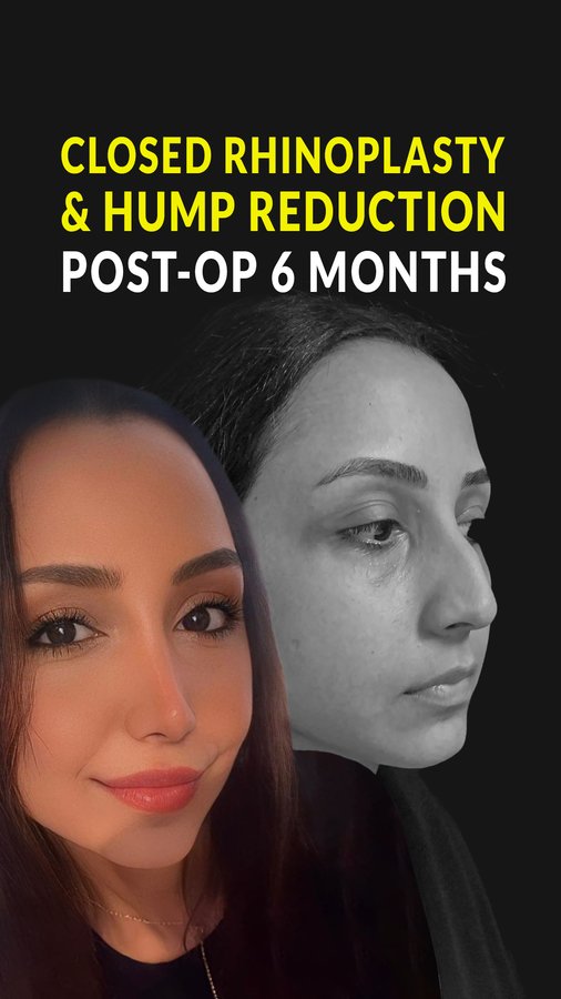 Dr. Bora Ok - Aesthetic Plastic Surgery Clinic - Dr. Bora Ok - Aesthetic Plastic Surgery Clinic