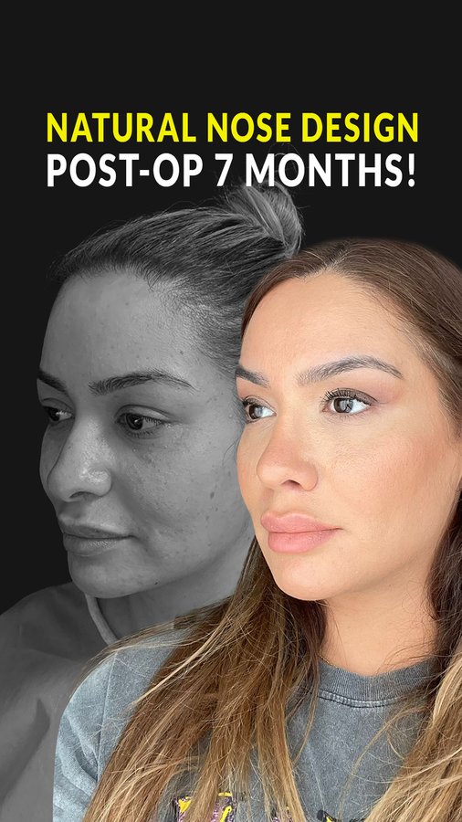 Dr. Bora Ok - Aesthetic Plastic Surgery Clinic - Dr. Bora Ok - Aesthetic Plastic Surgery Clinic