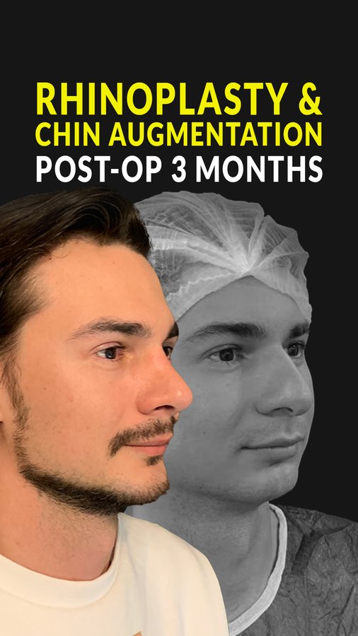 Dr. Bora Ok - Aesthetic Plastic Surgery Clinic - Dr. Bora Ok - Aesthetic Plastic Surgery Clinic