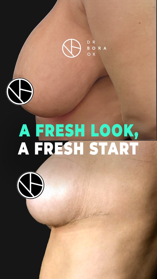 Dr. Bora Ok - Aesthetic Plastic Surgery Clinic - Dr. Bora Ok - Aesthetic Plastic Surgery Clinic