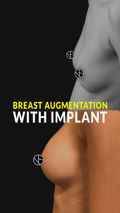 Dr. Bora Ok - Aesthetic Plastic Surgery Clinic - Dr. Bora Ok - Aesthetic Plastic Surgery Clinic