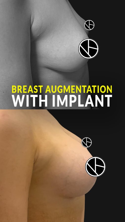 Dr. Bora Ok - Aesthetic Plastic Surgery Clinic - Dr. Bora Ok - Aesthetic Plastic Surgery Clinic