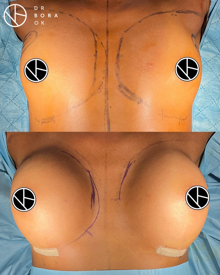 Dr. Bora Ok - Aesthetic Plastic Surgery Clinic - Dr. Bora Ok - Aesthetic Plastic Surgery Clinic